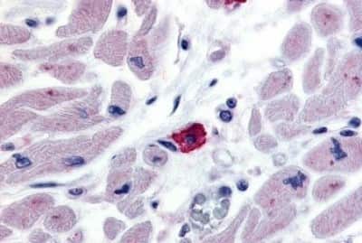 Immunohistochemistry-Paraffin EMR3 Antibody - BSA Free